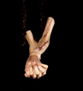 scarifications